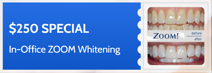 Lake Street Dental | Pediatric Dentistry, Veneers and Preventative Program